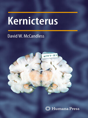 cover image of Kernicterus